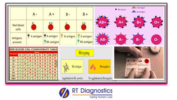 Blood Group Rh Typing RT Diagnostics